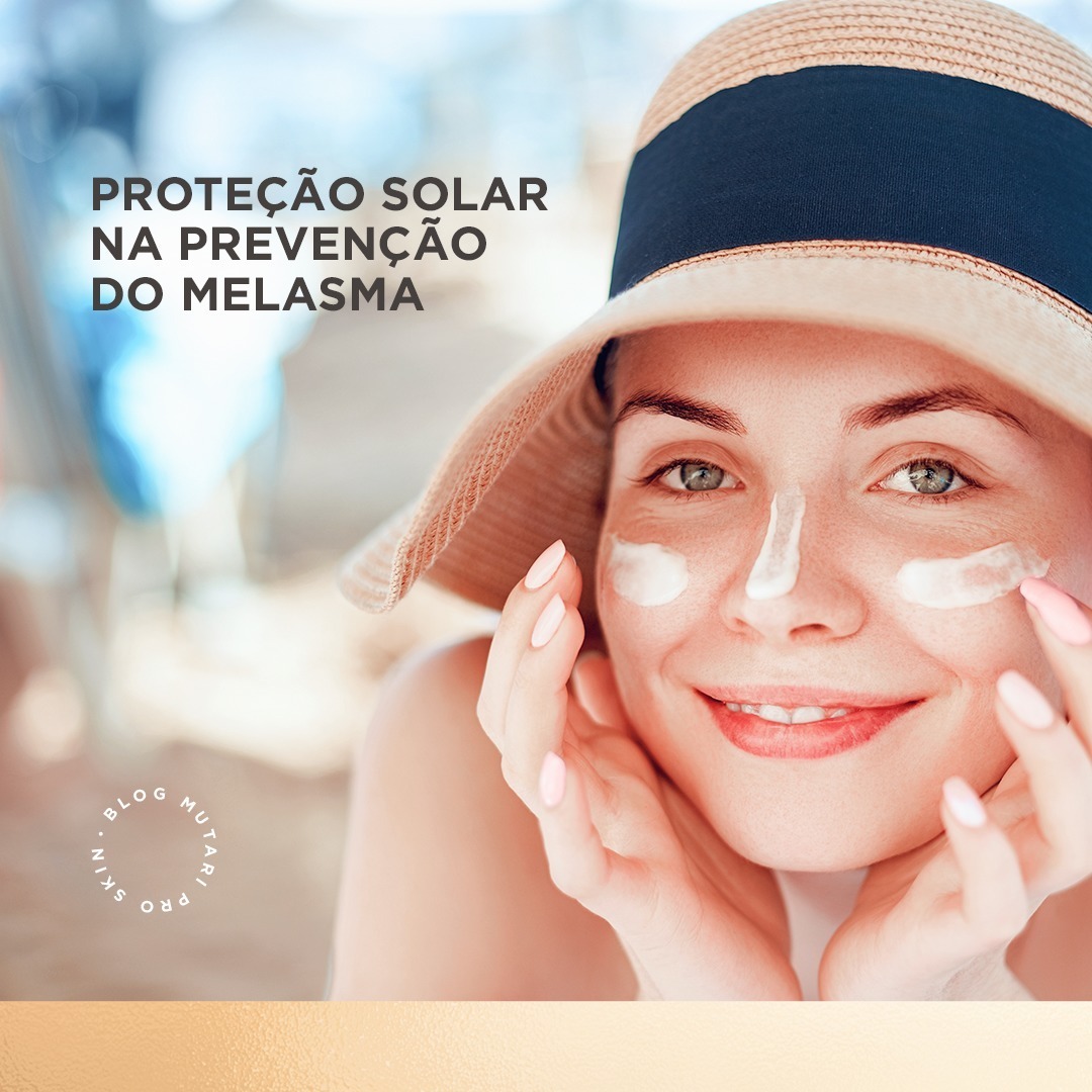 Você está visualizando atualmente Melasma – Como o uso do filtro solar pode te ajudar na Prevenção